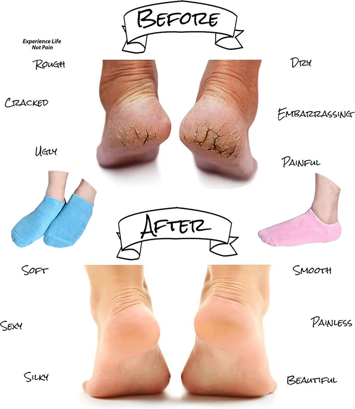Moisturizing Spa Gel Socks ( Hot Selling )